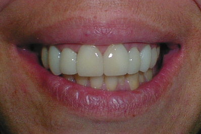 DSC00026